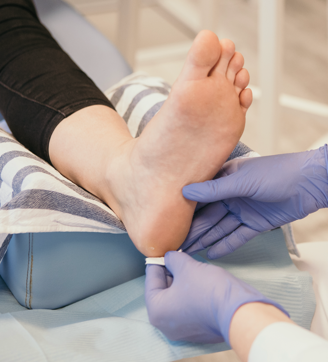 Callus Remover