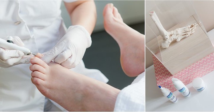 Professional Aftercare for Ingrown Toenails: Supporting Skin Recovery and Nail Protection with Imperial Feet