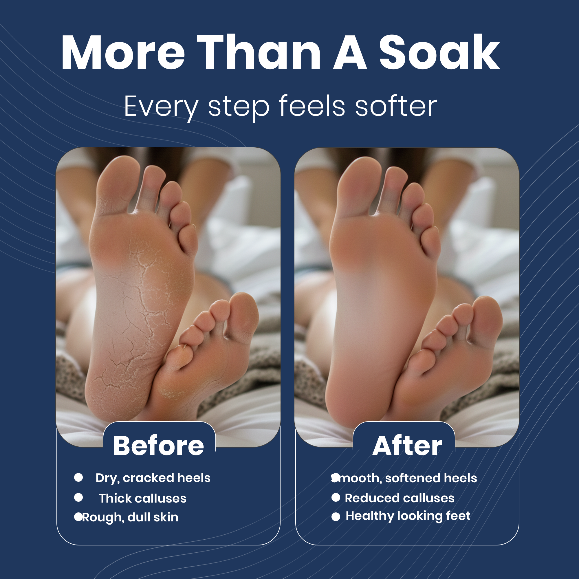 Cracks & Callus Foot Soak