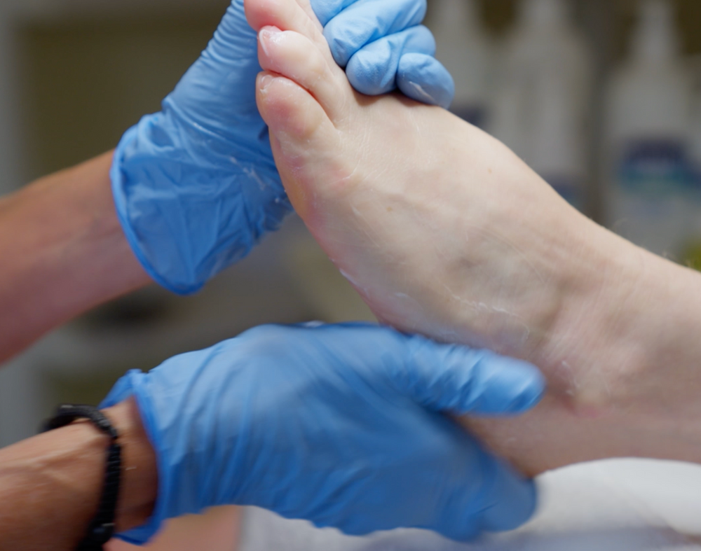 Moisturize the feet